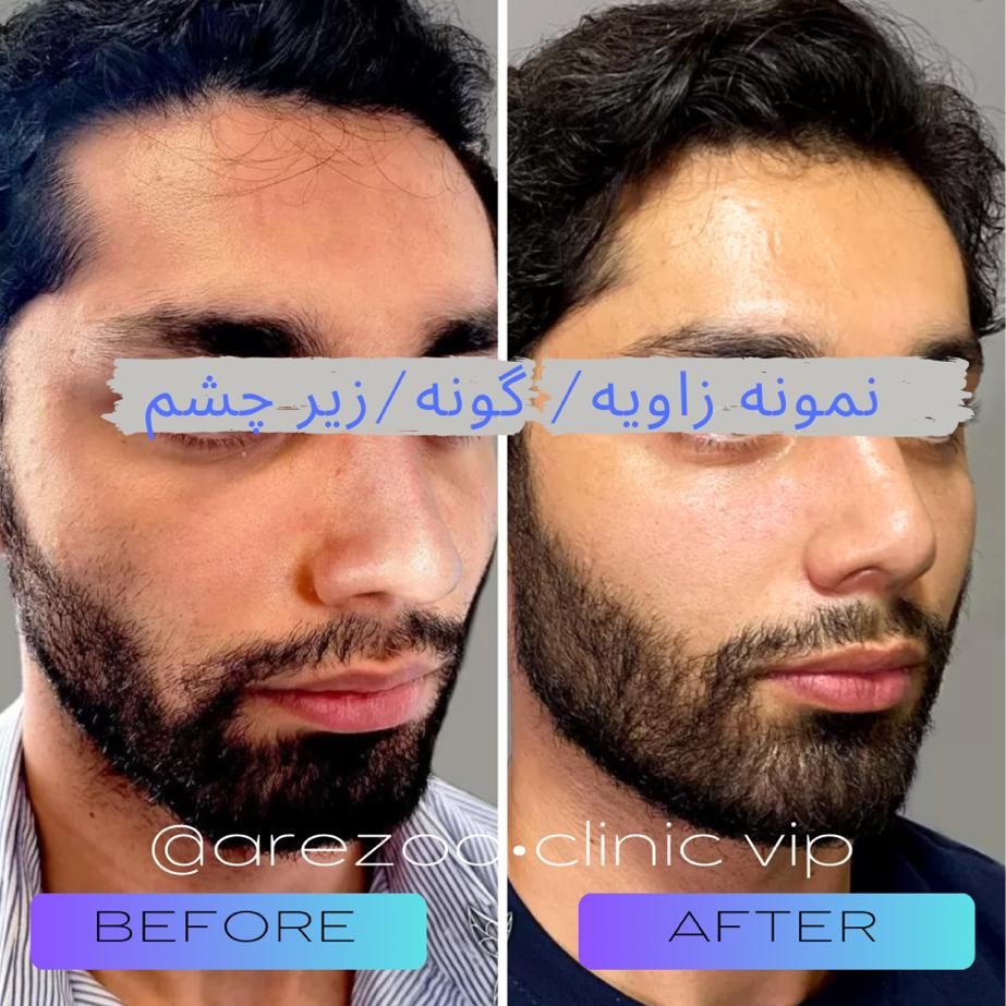 همکاری با مترجم**عربی زبان**در حوزه زیبایی پزشکی|استخدام بازاریابی و فروش|اصفهان, مرداویج|دیوار