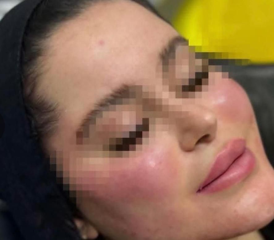 ژل هر ccفقط ۳۵۰|خدمات آرایشگری و زیبایی|اسلام‌شهر, صادقیه|دیوار