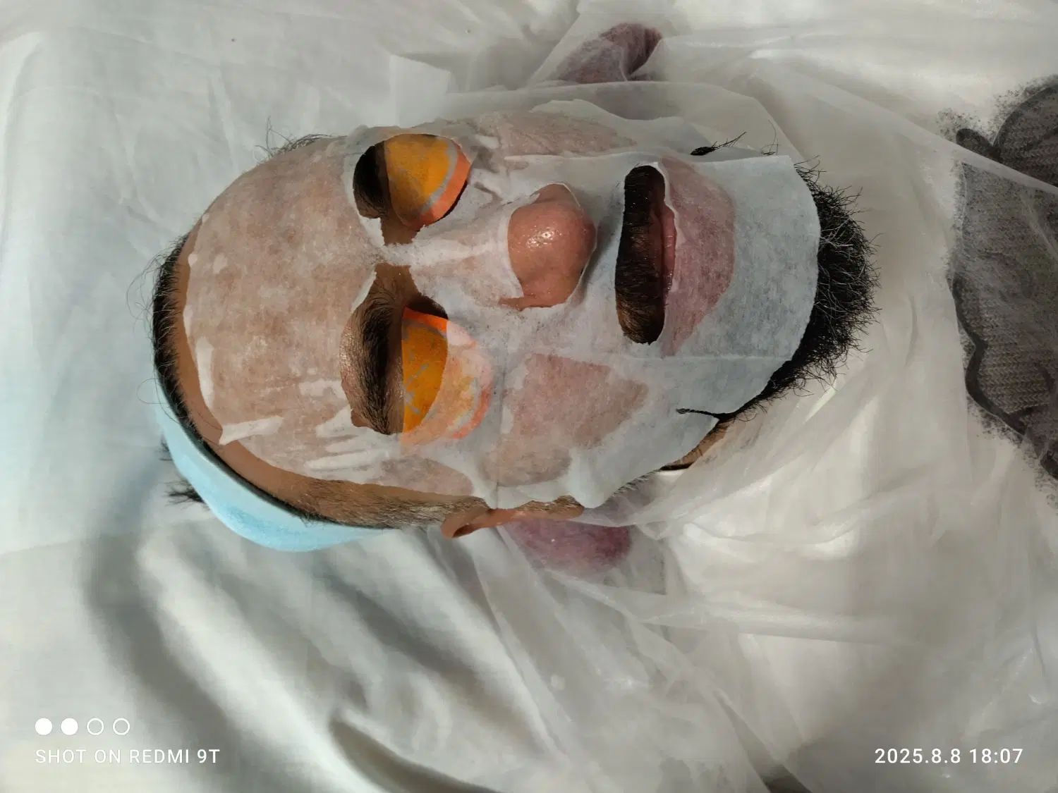 ۵۰درصد تخفیف فشیال تخصصی صورت ومزو  با اکلادو|خدمات آرایشگری و زیبایی|مشهد, حسابی جنوبی (شهرک غرب)|دیوار