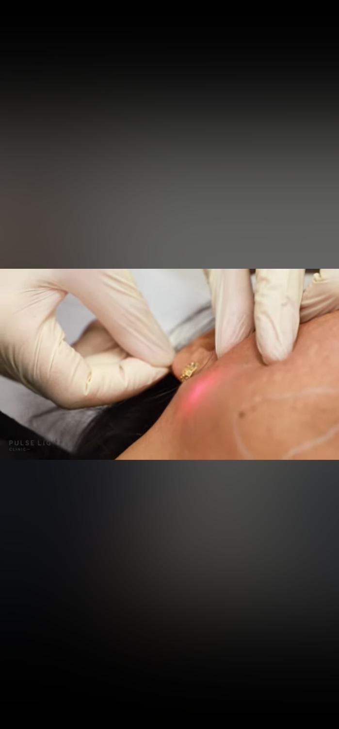 تزریق ژل وبوتاکس وپی آر پی با قیمت های باور نکردنی|خدمات آرایشگری و زیبایی|اصفهان, شمس آباد|دیوار