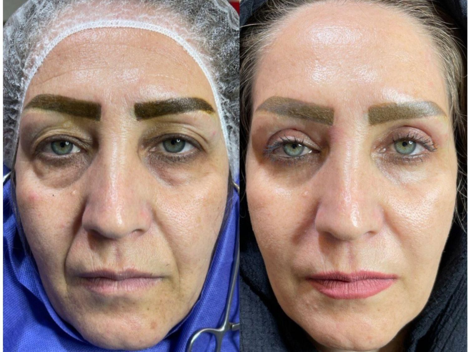 جراحی‌های زیبایی توسط متخصص در بیمارستان قم|خدمات آرایشگری و زیبایی|قم, بلوار امین و ساحلی|دیوار