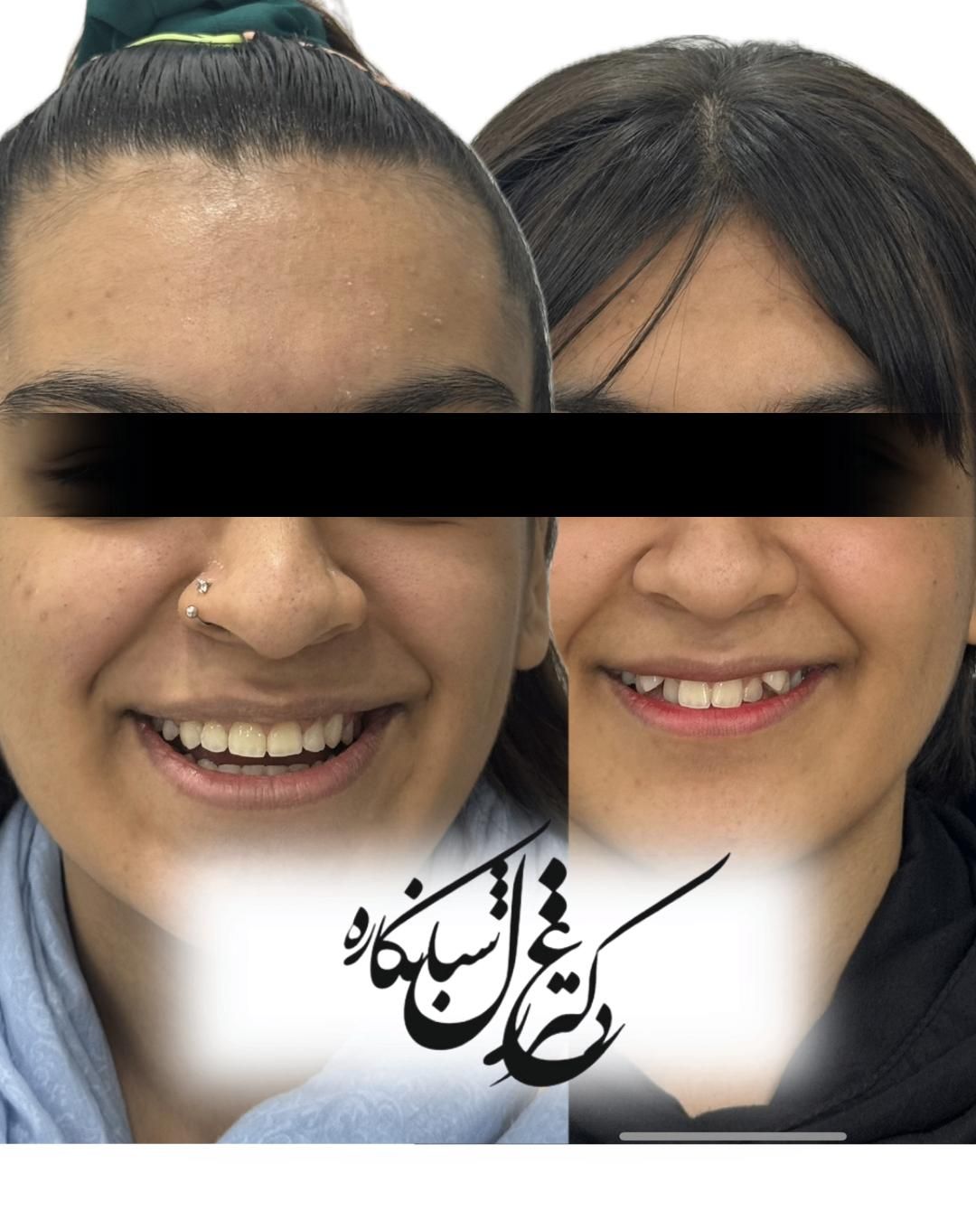 ارتودنسی با شرایط اقساط و منعطف|خدمات آرایشگری و زیبایی|تهران, دزاشیب|دیوار