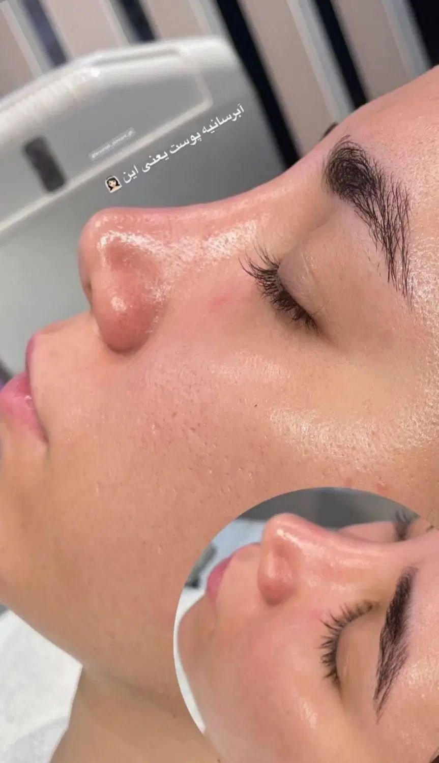 مژده مژده تخفیف فشیال و پاکسازی پوست فقط ۱۹۰تومن|خدمات آرایشگری و زیبایی|مشهد, طبرسی شمالی|دیوار