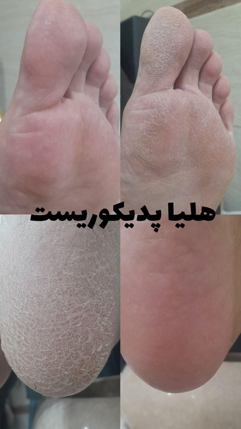 تخصصی ترین کفسابی باهلیا|خدمات آرایشگری و زیبایی|کرمان, |دیوار