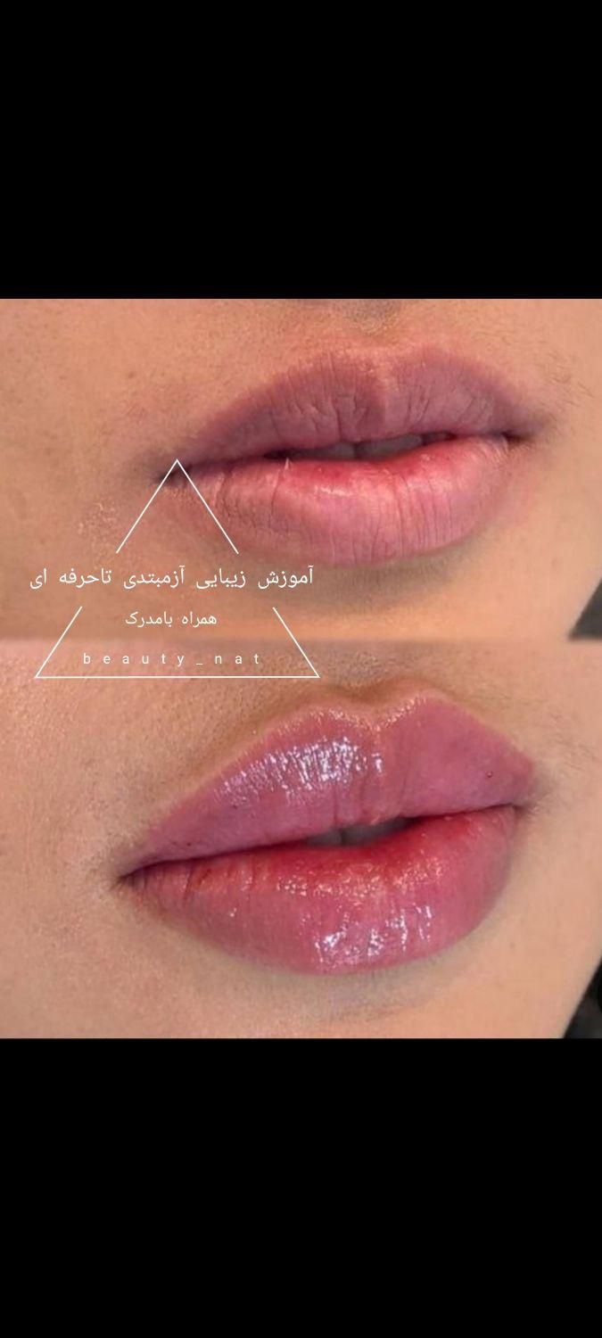 خدمات ژل وبوتاکس /کاشت مووابرو/باکمترین قیمت|خدمات آرایشگری و زیبایی|خرم‌آباد, |دیوار