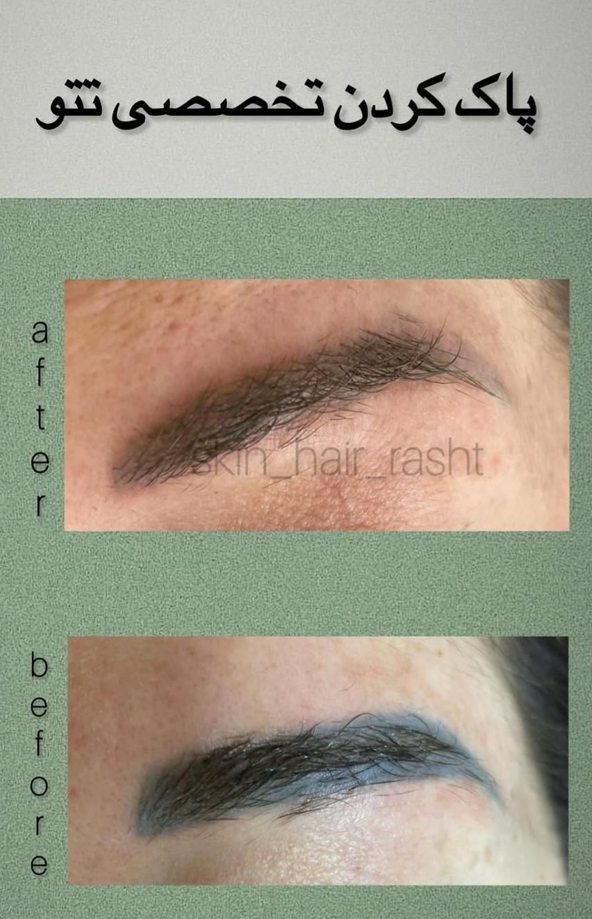 مرکز مراقبت پوست مو لاغری رشت|خدمات آرایشگری و زیبایی|رشت, گلباغ نماز|دیوار