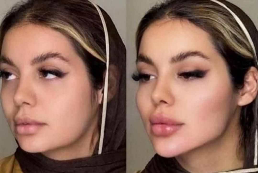پنجاه درصد تخفیف ژل صورت|خدمات آرایشگری و زیبایی|اهواز, پادادشهر|دیوار