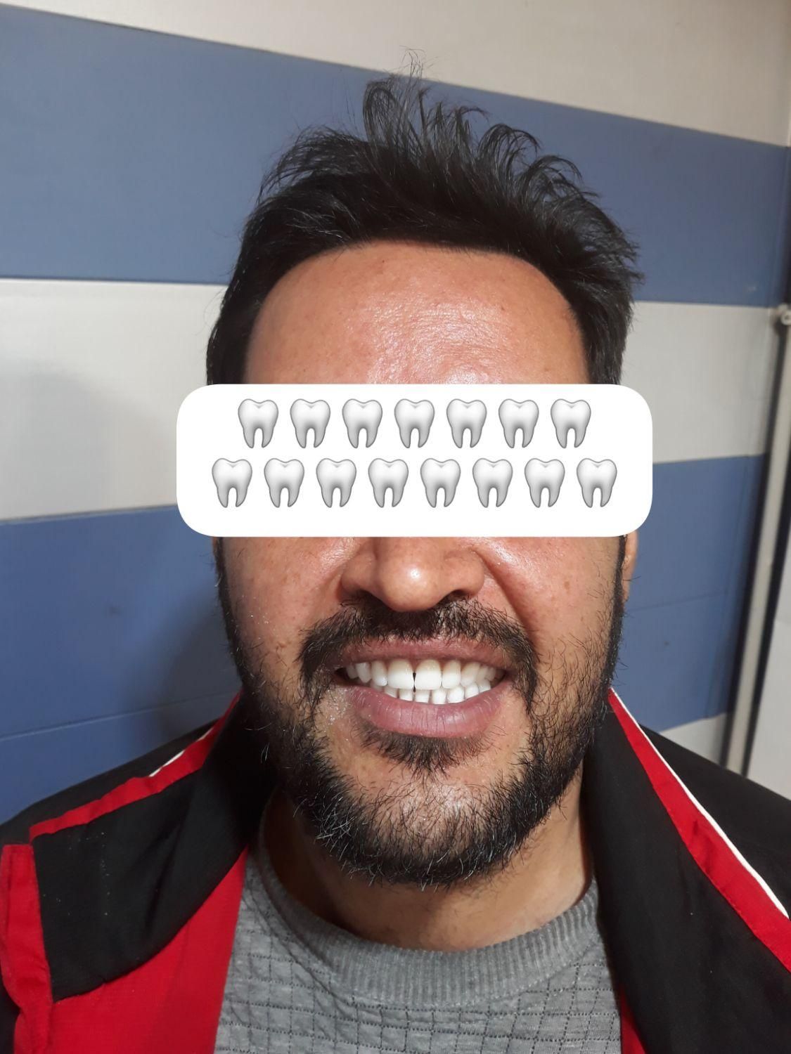 دندانسازی رستمی|خدمات آرایشگری و زیبایی|زنجان, |دیوار