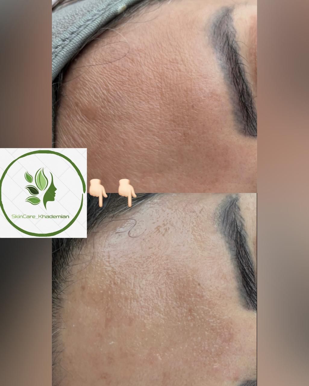 فیشال فقط ۳۵۰ (پاکسازی پوست) حرفه ای به مدت محدود|خدمات آرایشگری و زیبایی|صدرا-فارس, فاز ۱|دیوار