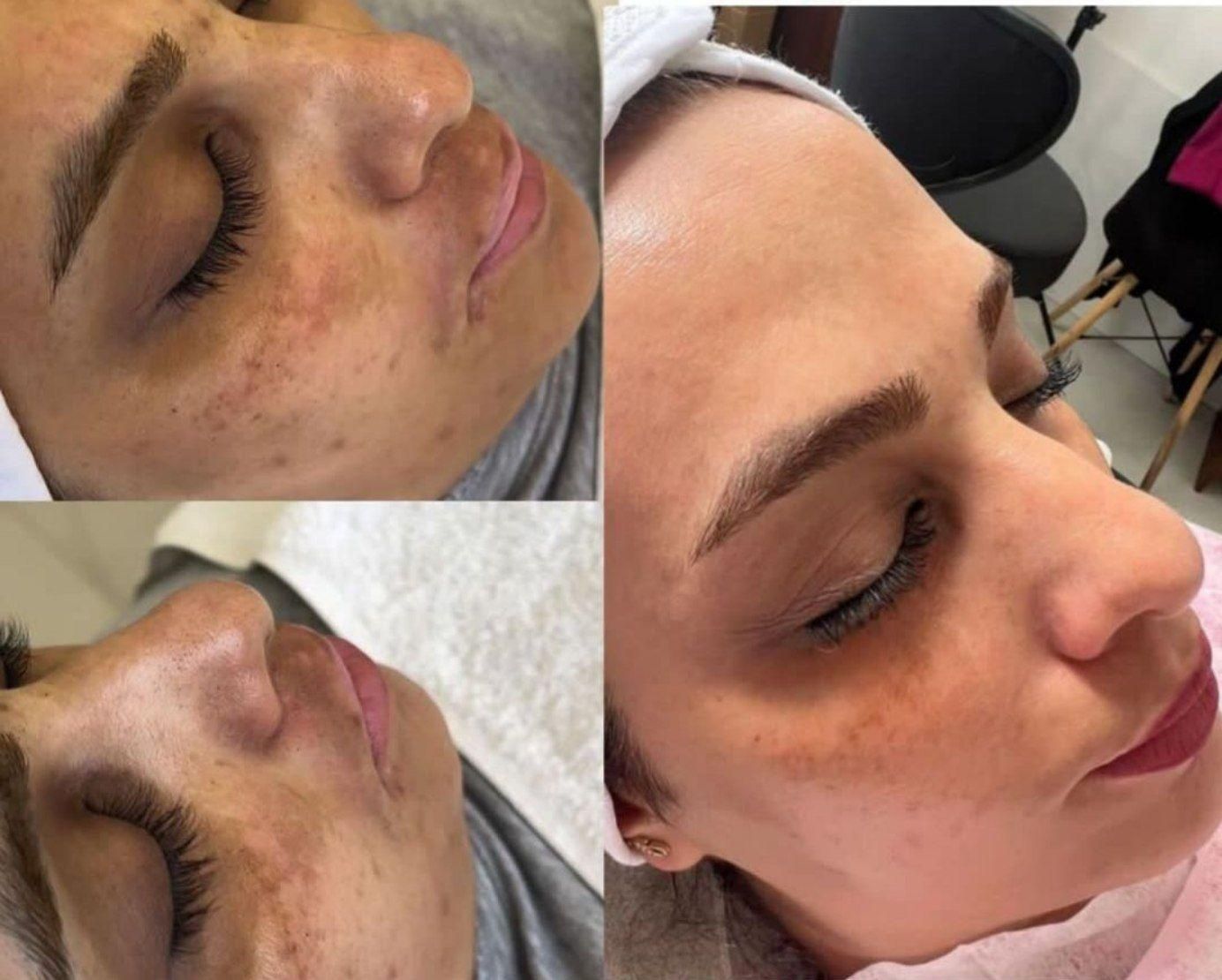 پیراپزشک طب سنتی متخصص پوست|خدمات آرایشگری و زیبایی|رشت, رودباری|دیوار