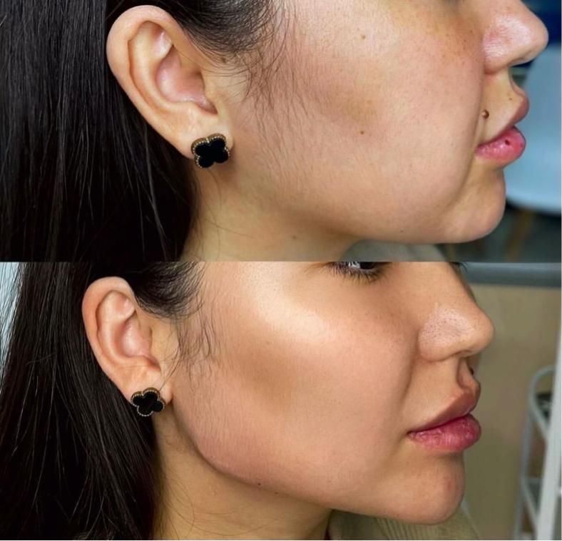 کلینیک تزریق ژل لب روسیm مادلینگ mdبوتاکس لیزر|خدمات آرایشگری و زیبایی|تهران, صادقیه|دیوار