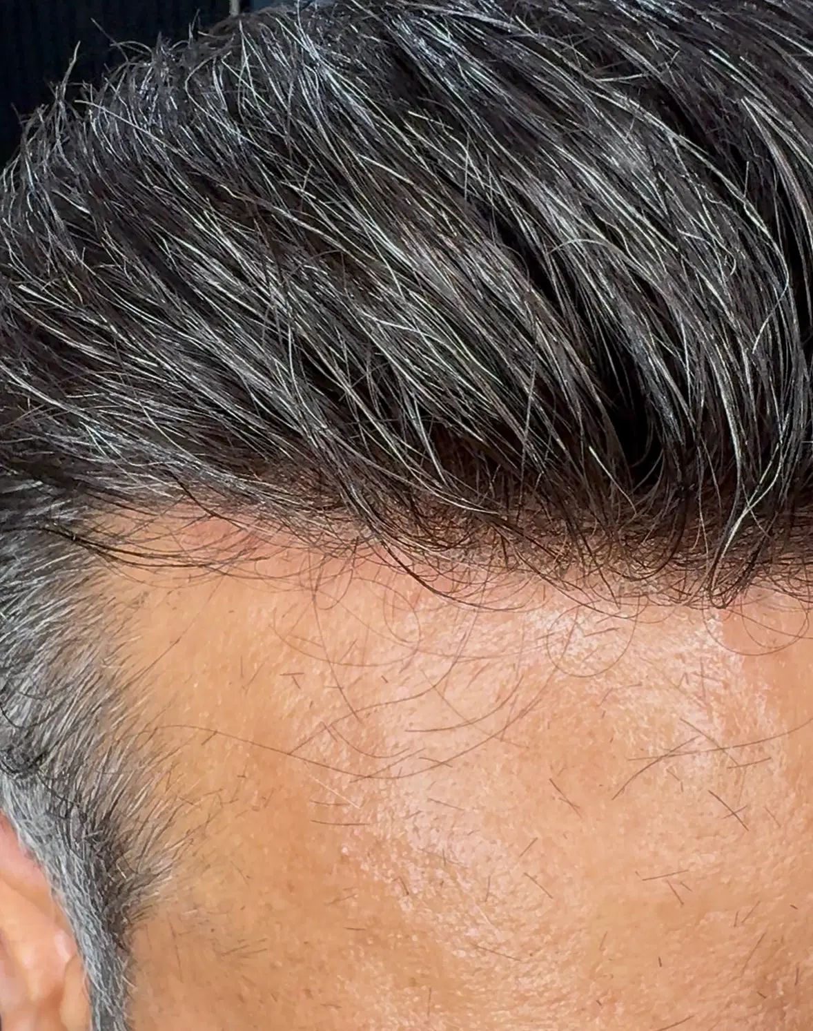 انواع پروتز مو فقط اورجینال وارداتی(نقد و اقساط)|آرایشی، بهداشتی، درمانی|تهران, فردوس|دیوار