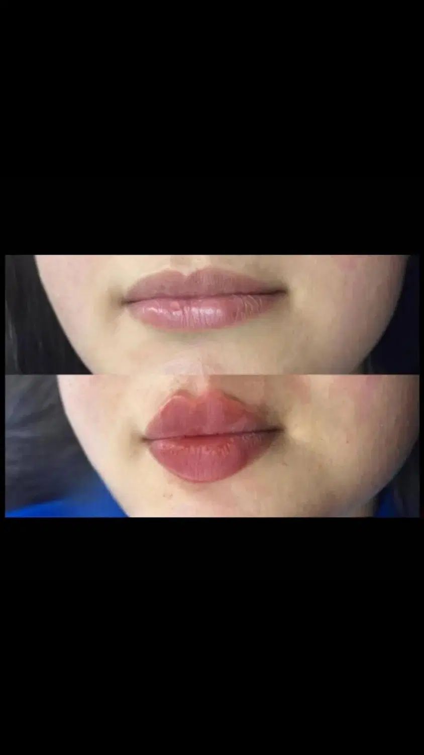 آموزش وتزریق،ژل،بوتاکس،مزوژل زیرچشم،آنزیم ومزو|خدمات آرایشگری و زیبایی|کرج, فاز ۳ گوهردشت|دیوار