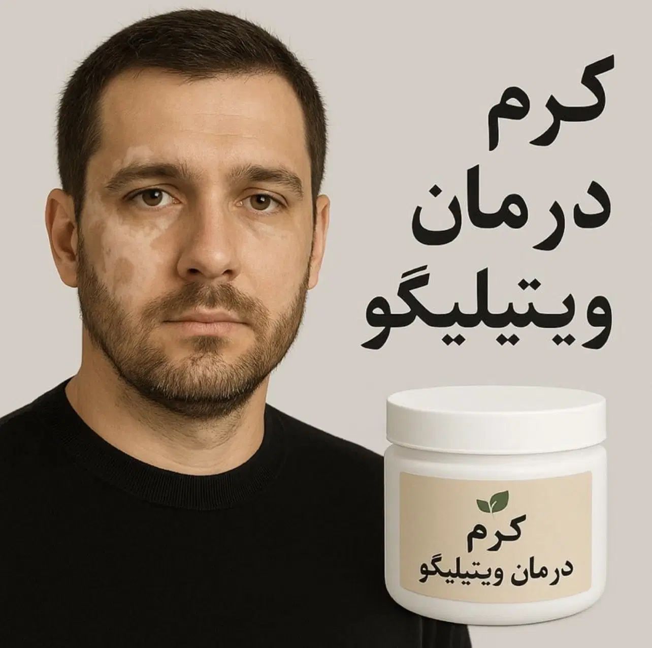 کرم درمان ویتیلیگو ( لکه های سفید )|آرایشی، بهداشتی، درمانی|تهران, فلسطین (میدان انقلاب)|دیوار
