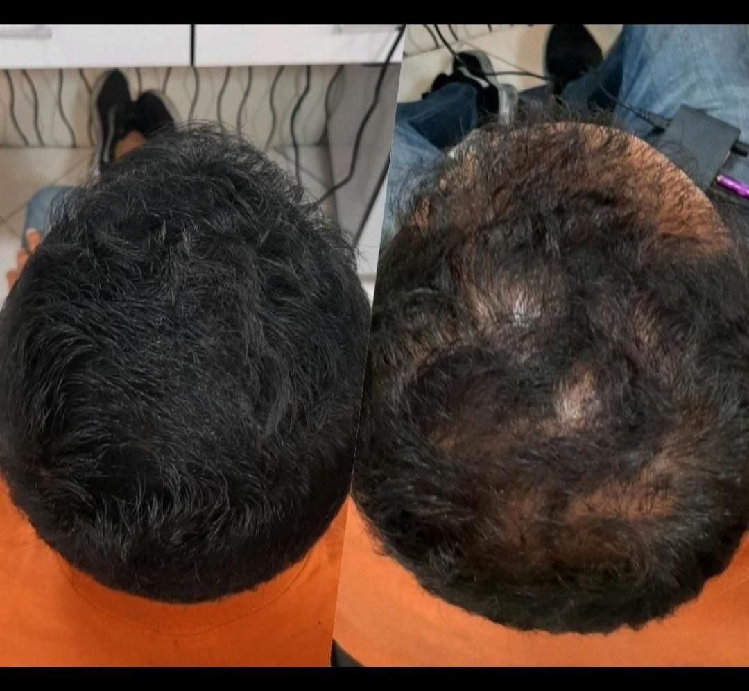 تخفیف 80درصدی در قم  پی ار پی(۹۶۰) فقط تا جمعه|خدمات آرایشگری و زیبایی|قم, زنبیل آباد|دیوار