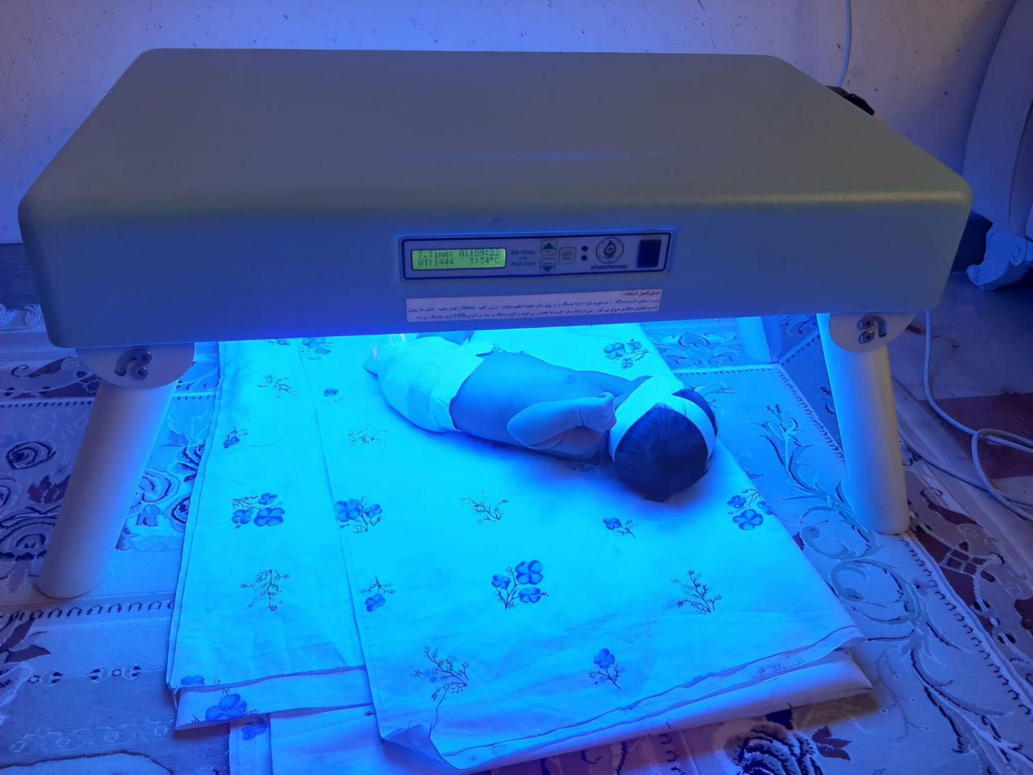 دستگاه زردی نوزاد،فتوتراپی دیجیتال جهت درمان زردی|پزشکی|بوشهر, |دیوار