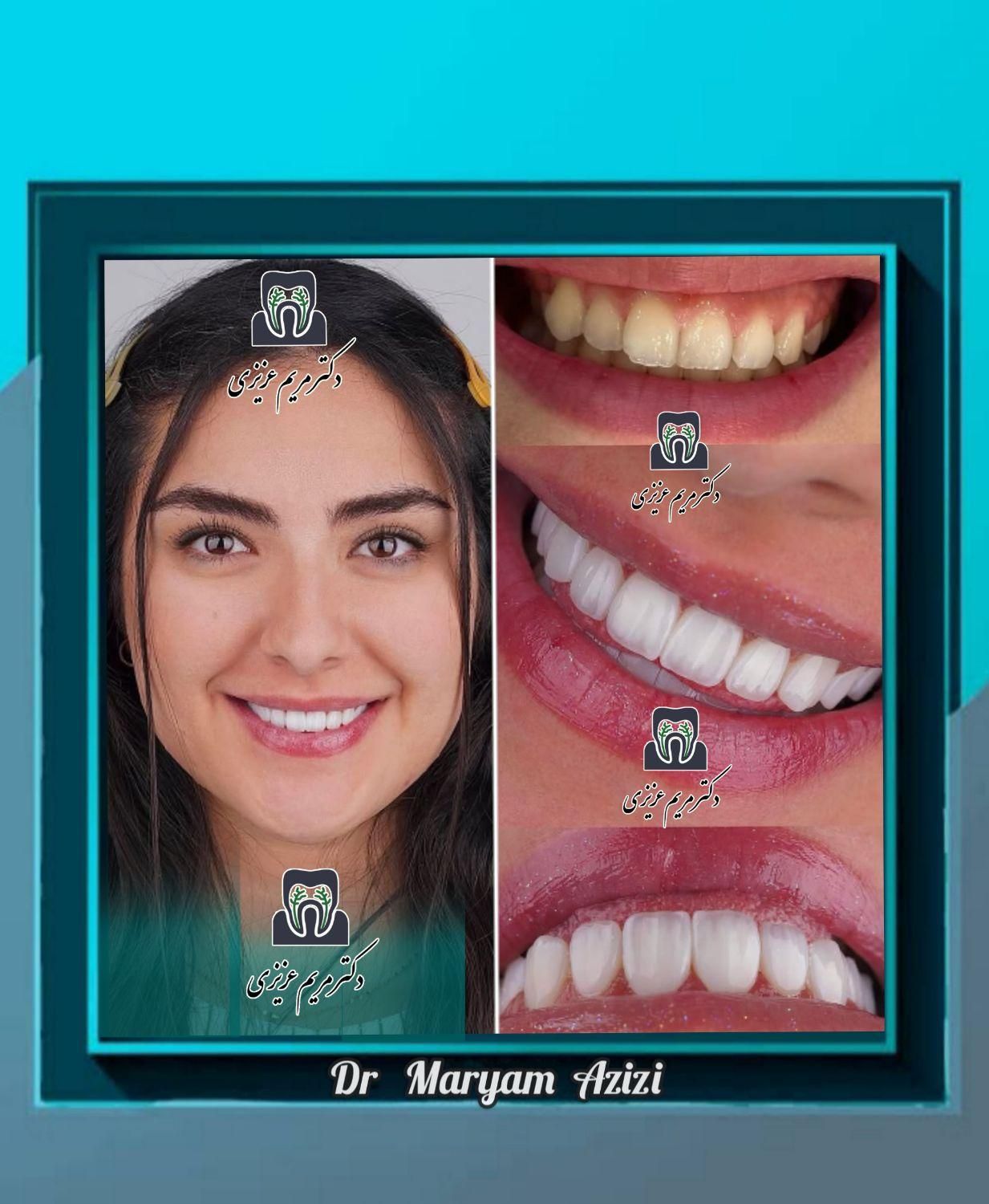 مرکز تخصصی دندانپزشکی عصب کشی دندان پزشکی|خدمات آرایشگری و زیبایی|شیراز, معالی‌آباد|دیوار