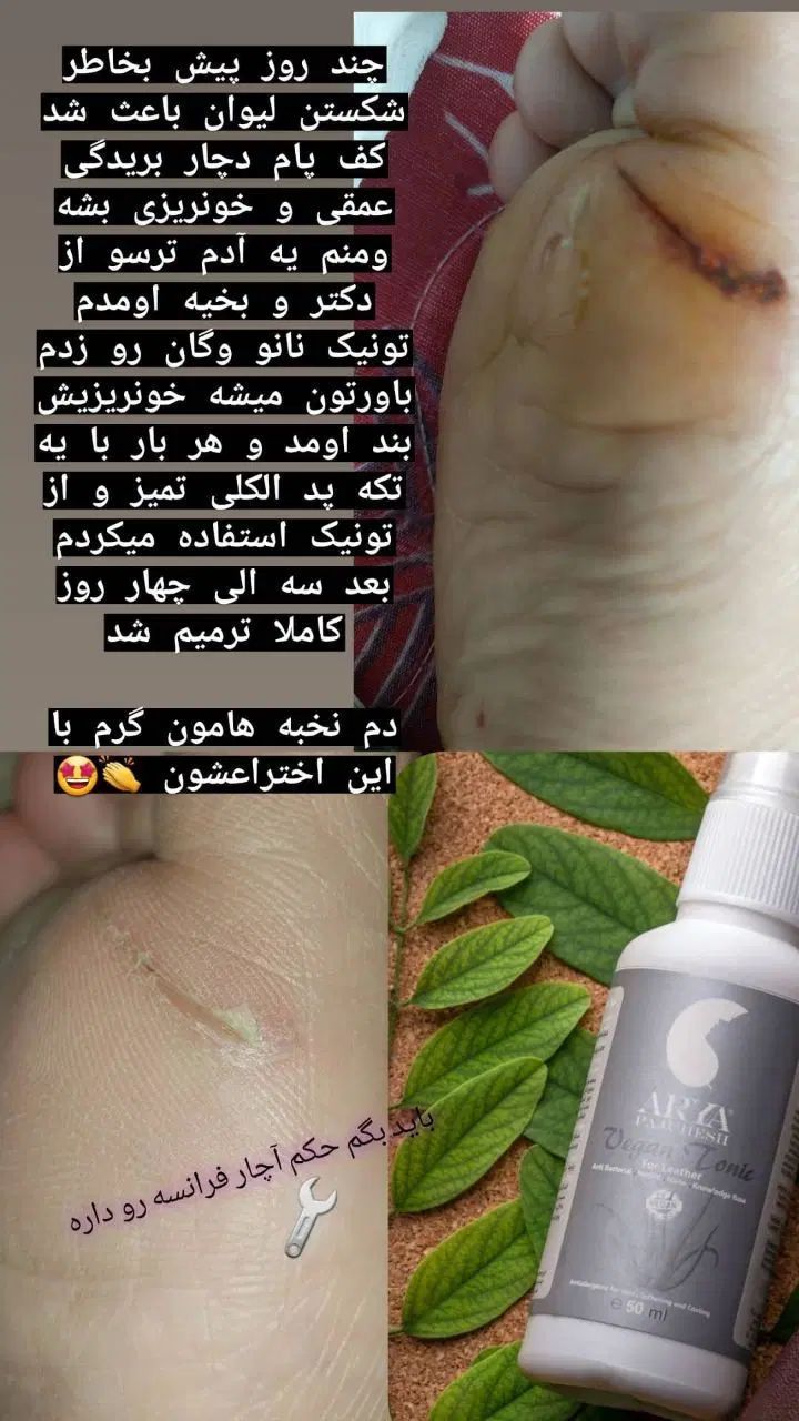 تونیک نانو وگان  مخصوص زخم وتیرگی پوست|آرایشی، بهداشتی، درمانی|تهران, استخر|دیوار