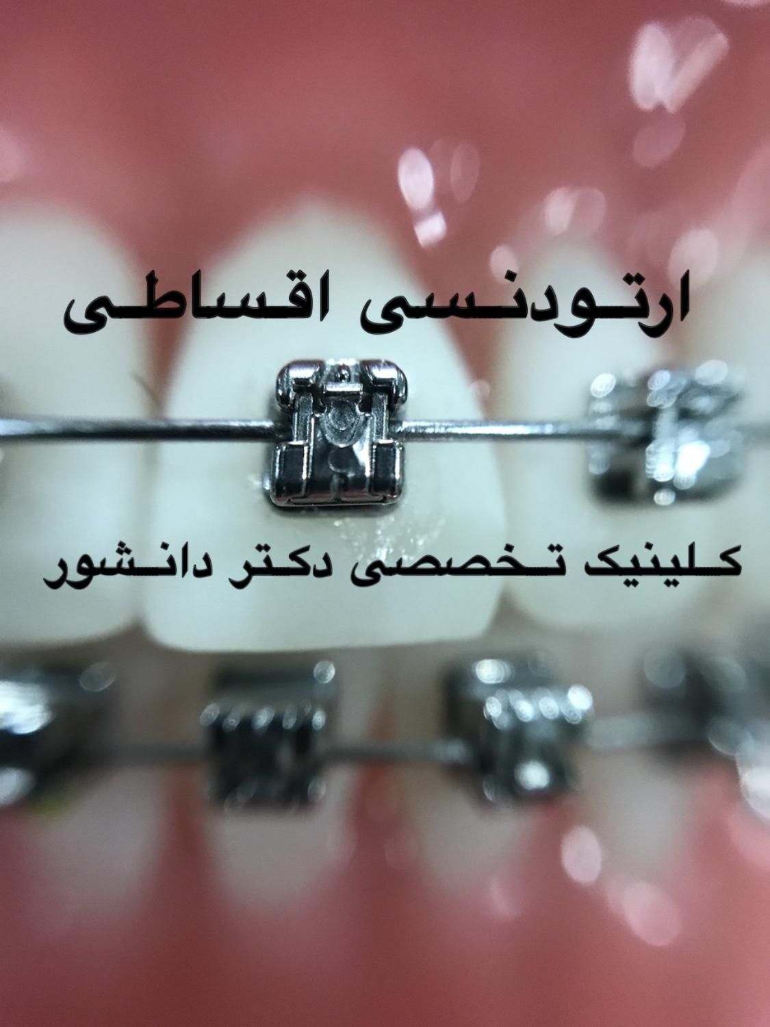 ارتودنسی تخصصی کلینیک دکتر دانشور|خدمات آرایشگری و زیبایی|شیراز, معالی‌آباد|دیوار