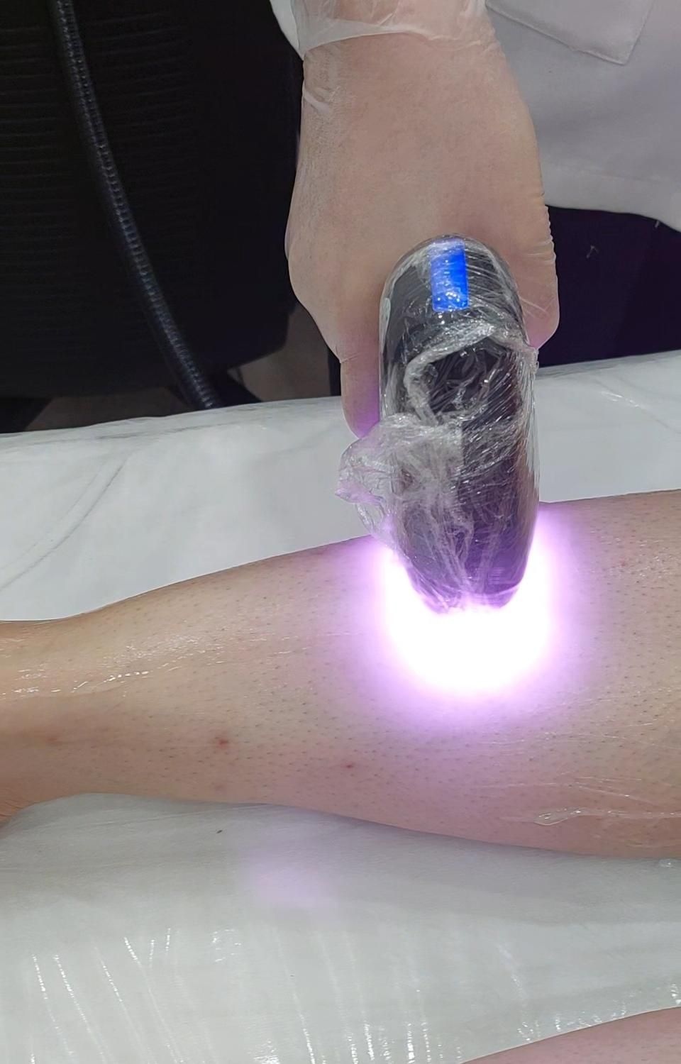 جشنواره پاییزه لیزرتضمینی موهای زائد|خدمات آرایشگری و زیبایی|ساری, |دیوار