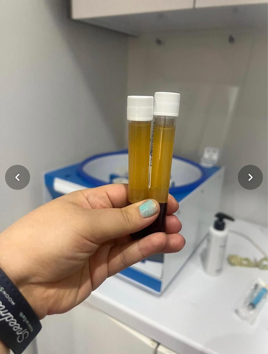 جشنواره ی پاییزه فیلر زیرچشم و شقیقه پی آرپی فیشال|خدمات آرایشگری و زیبایی|تهران, سعادت‌آباد|دیوار