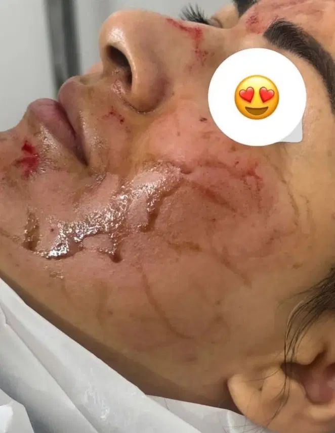 پاکسازی تخصصی درمانی پوست و ماساژصورت وبدن|خدمات آرایشگری و زیبایی|تربت‌حیدریه, نواب صفوی|دیوار