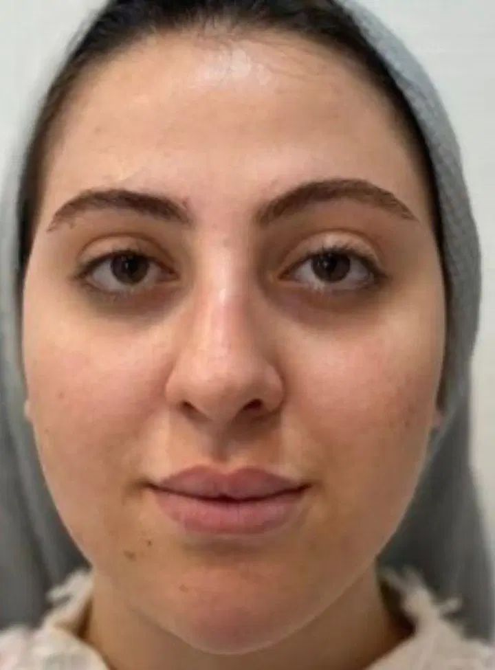 کاشت پدیکور میکاپ|خدمات آرایشگری و زیبایی|کرمانشاه, |دیوار