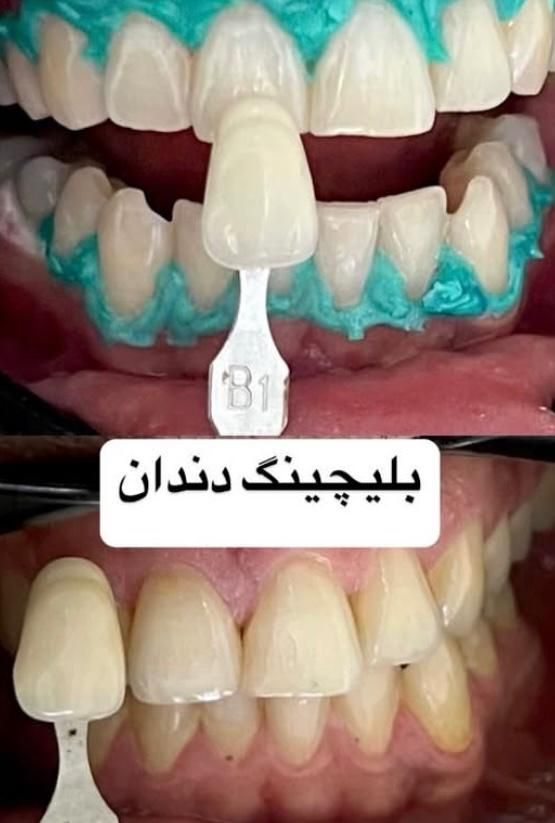 تخفیفات ۳۰ درصدی افتتاح مطب دندانپزشکی|خدمات آرایشگری و زیبایی|اهواز, کیانپارس |دیوار