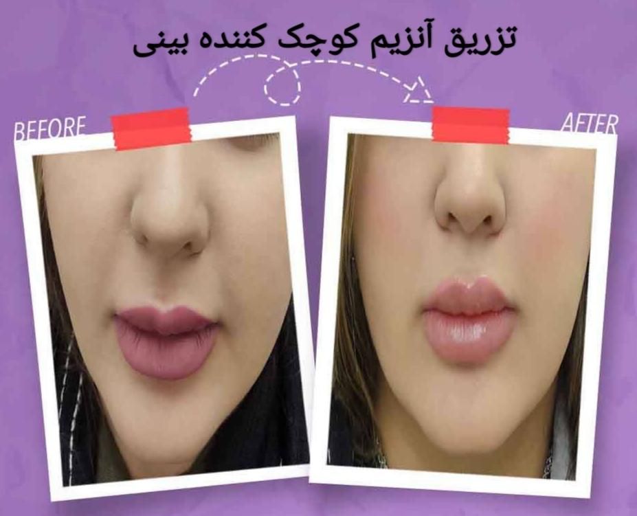 خدمات زیبایی جامع با بهترین کیفیت|خدمات آرایشگری و زیبایی|اصفهان, شاهزاده ابراهیم|دیوار