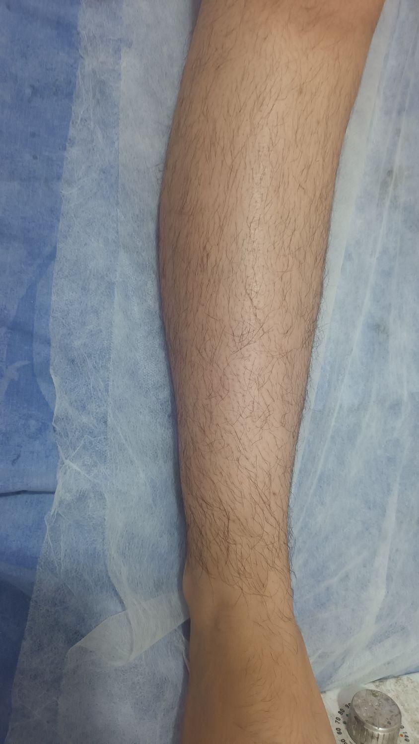 مدل اپلاسیون دائم/اصلاح صورت و ابرو/وکس(شمع)|خدمات آرایشگری و زیبایی|یزد, |دیوار