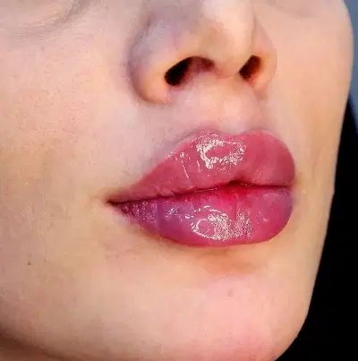 تخفیفات ژل و بوتاکس ومزوتراپی (آموزش۴ونیم)|خدمات آرایشگری و زیبایی|خرم‌آباد, |دیوار