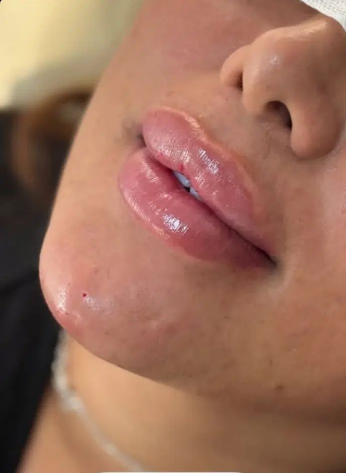 کلینیک زیبایی خدمات فیلر بوتاکس مزوژل PRP|خدمات آرایشگری و زیبایی|اهواز, کیان اباد|دیوار