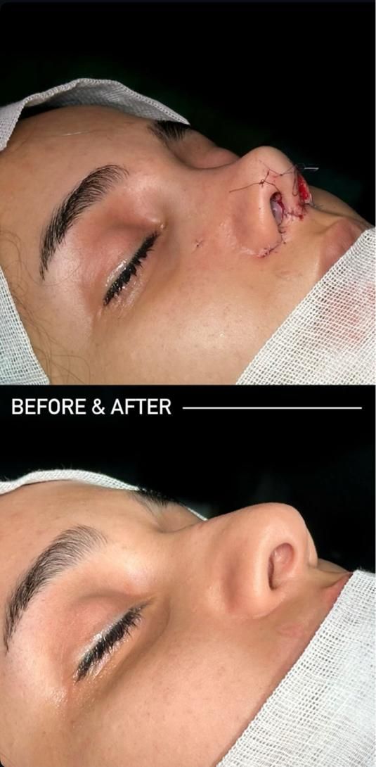 عمل جراحی بینی /لیفت صورت/پلک|خدمات آرایشگری و زیبایی|کرج, عظیمیه|دیوار