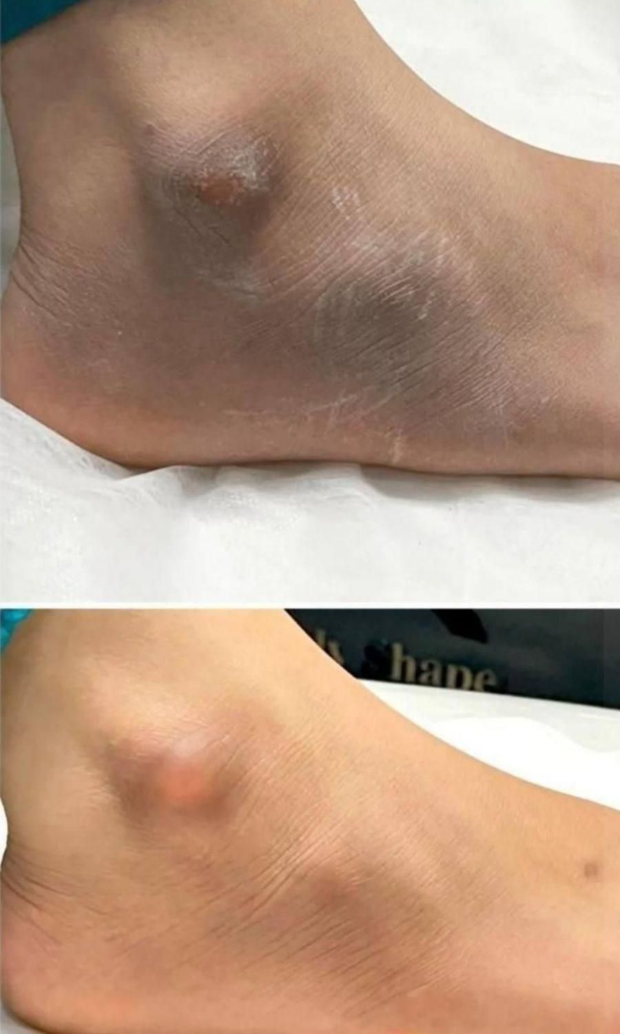 رفع تیرگی های بدن و صورت|خدمات آرایشگری و زیبایی|قم, زنبیل آباد|دیوار