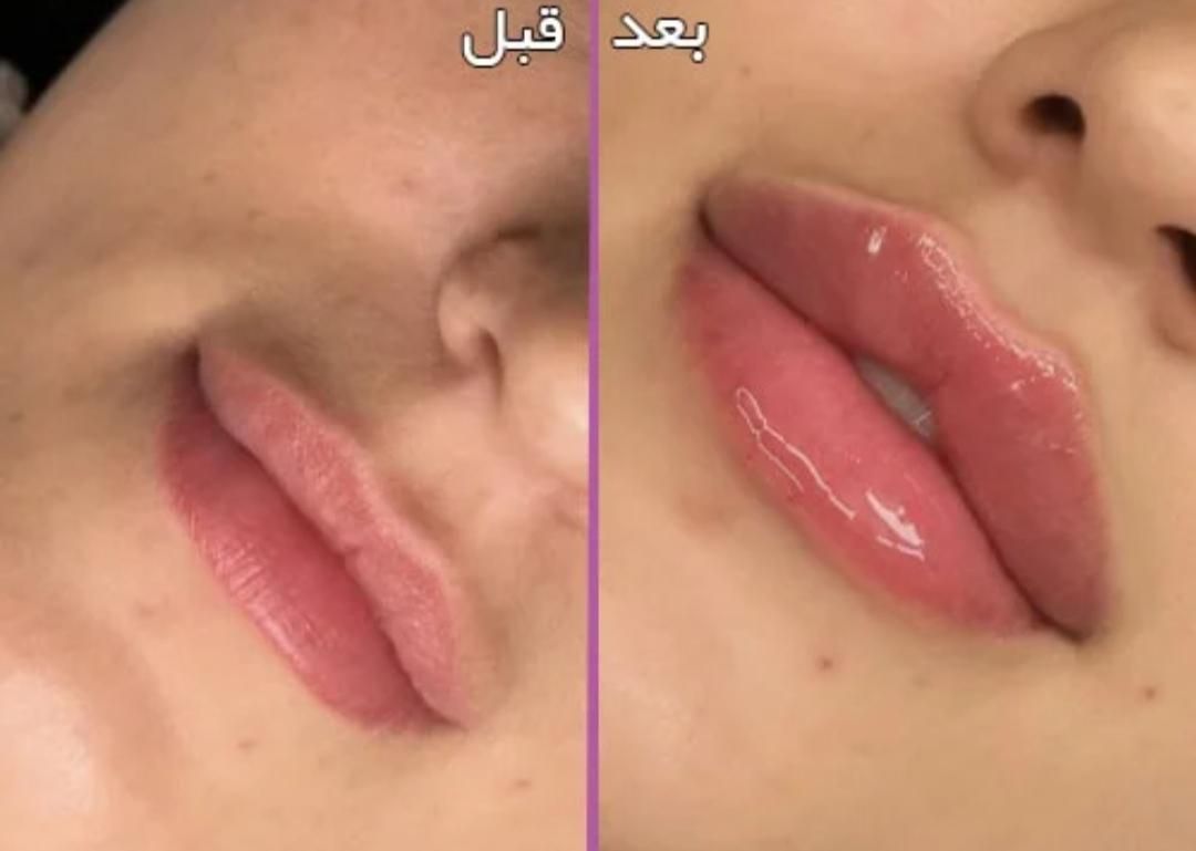 ژل لب فقط ۳۸۰|خدمات آرایشگری و زیبایی|شیراز, شهرک فرهنگیان|دیوار
