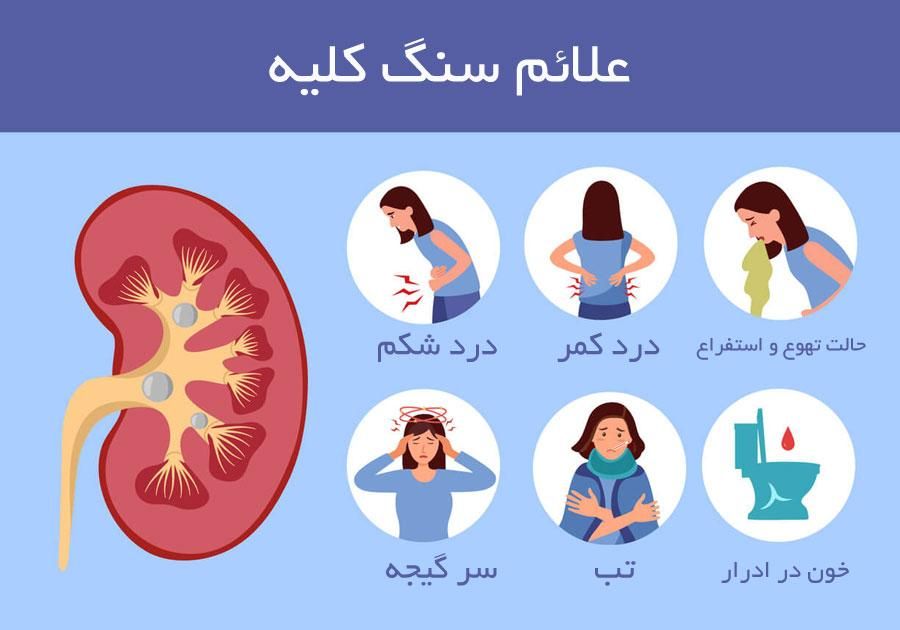 مکمل دفع سنگ کلیه|خدمات آرایشگری و زیبایی|ساوه, |دیوار