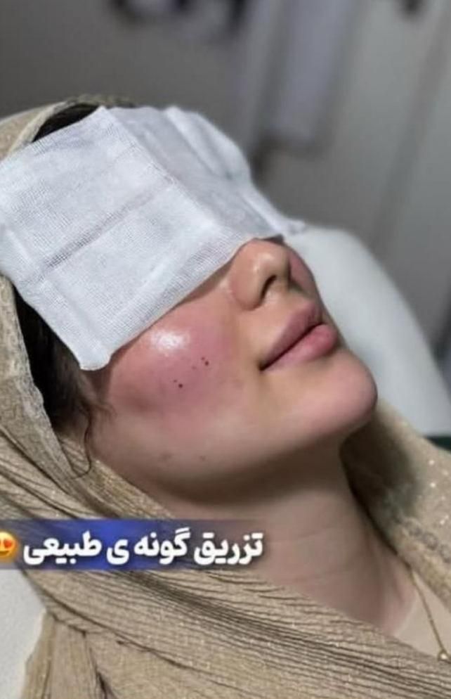 آفر آنزیم ،ژل وفیلر بادی،ساکشن ،کانتورینگ،بوتاکس|خدمات آرایشگری و زیبایی|کرج, گلشهر|دیوار