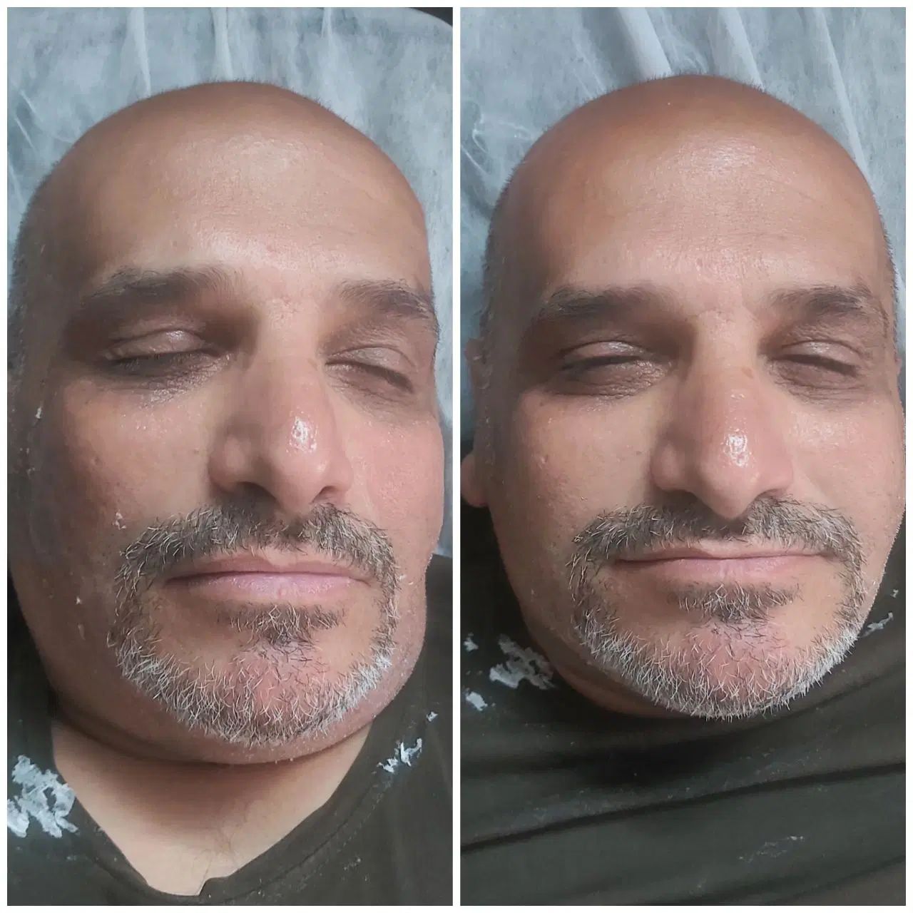 لاغری شکم پهلو ران بازو مزو مو مزو غبغب لیفت سینه|خدمات آرایشگری و زیبایی|تهران, سبلان (لشگر)|دیوار