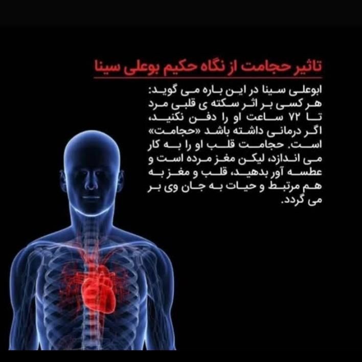 حجامت وبادکش تخصصی و زالودرمانی بادکش رشدقدی|خدمات آرایشگری و زیبایی|تهران, آهنگ|دیوار