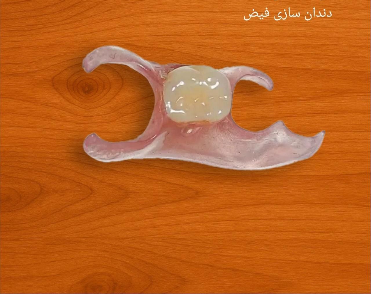 دندان‌سازی. دندان‌مصنوعی. لابراتوار دندانسازی|خدمات آرایشگری و زیبایی|مشهد, ولیعصر (شهرک غرب)|دیوار
