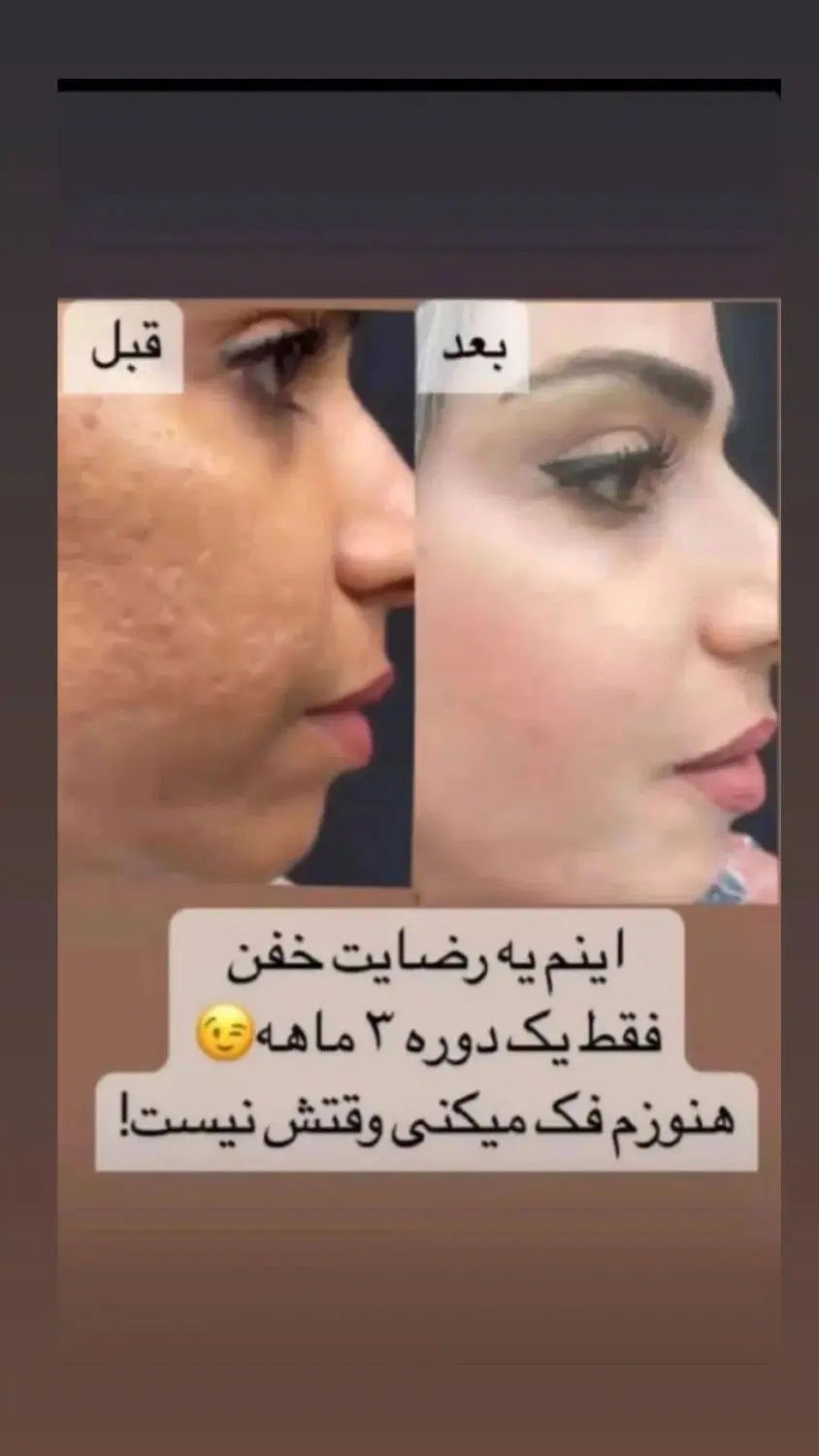 صابون روشن کننده و لایه بردار و کرم مرطوب کننده|آرایشی، بهداشتی، درمانی|سمنان, |دیوار
