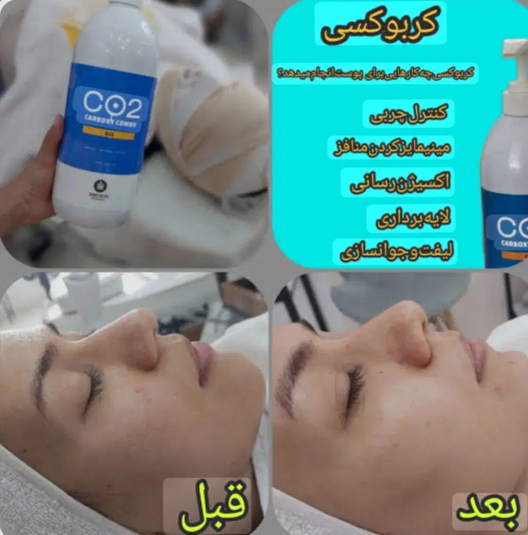 فشیال کلاسیکvip پوست فقط 400تومان به جای 600تومان|خدمات آرایشگری و زیبایی|کرمان, |دیوار