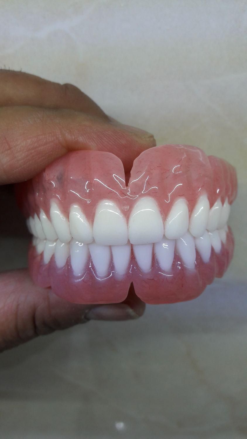 دندان مصنوعی|خدمات آرایشگری و زیبایی|قرچک, محمد آباد|دیوار