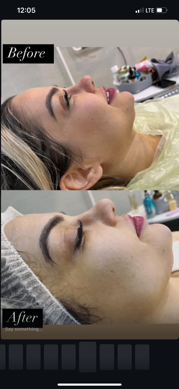 آموزش فشیال صورت. پاکسازی تخصصی و مدل پاکسازی پوست|خدمات آرایشگری و زیبایی|رشت, معلم|دیوار