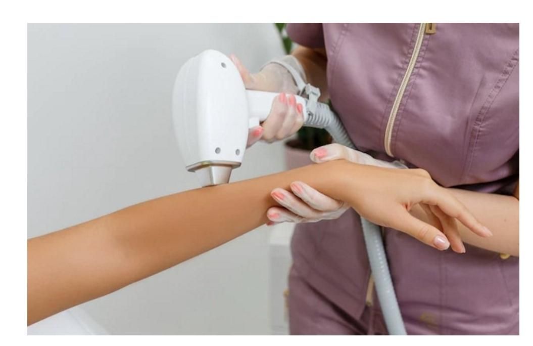 آخرین فرصت جشنواره لیزر موهای زائد|خدمات آرایشگری و زیبایی|کرمانشاه, |دیوار