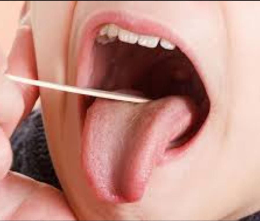آموزش بندی( درمان گیر کردن جسم در گلو)|خدمات آموزشی|مشهد, جانباز|دیوار