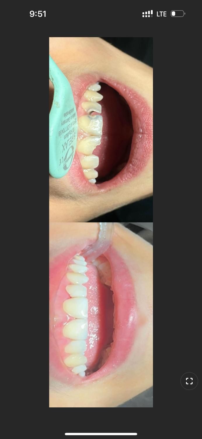 جشنواره دندانپزشکی زیبایی و درمانی|خدمات آرایشگری و زیبایی|تبریز, |دیوار