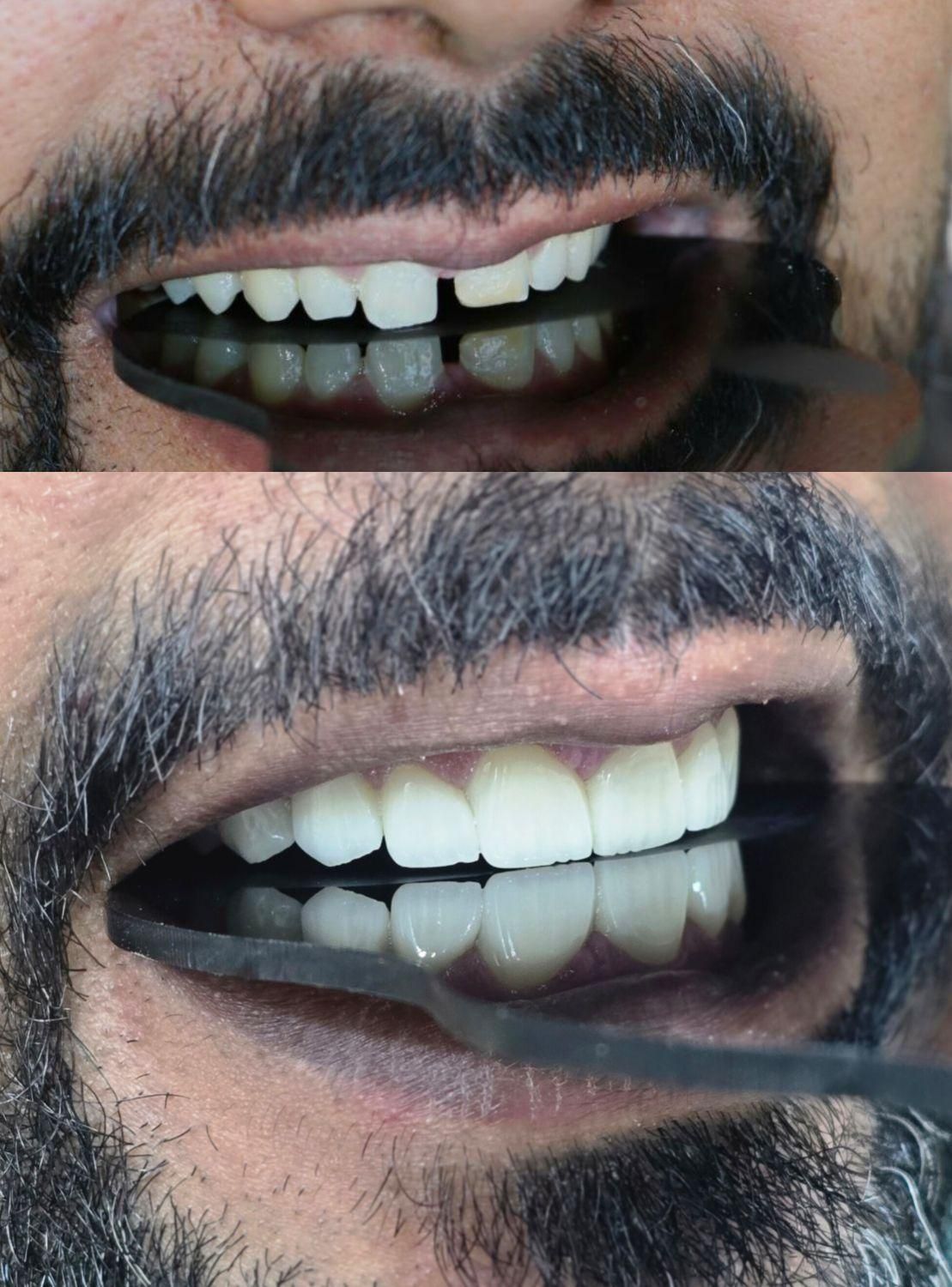 جشنواره اقساطی دندانپزشکی بدون پیش پرداخت|خدمات آرایشگری و زیبایی|شیراز, بعثت|دیوار