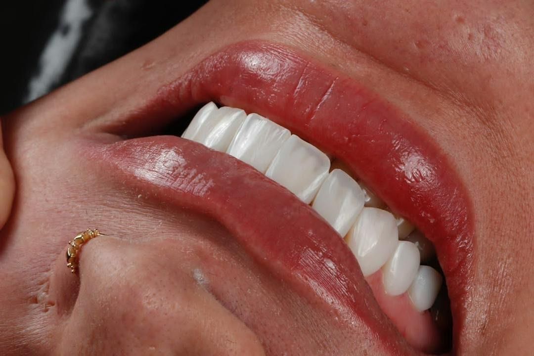 فیلمبردار و ادیتور جهت دندانپزشکی|استخدام هنری و رسانه|تهران, نیاوران|دیوار