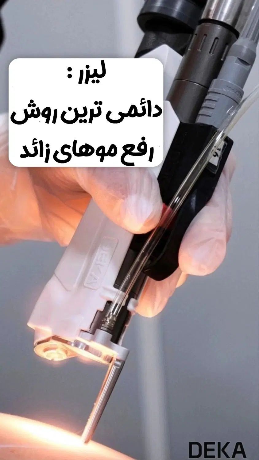 مرکز لیزر الکساندرایت دکا ایتالیا مشهد|خدمات آرایشگری و زیبایی|مشهد, کوه سنگی|دیوار